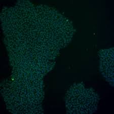 UMi049-A · Cell Line · hPSCreg