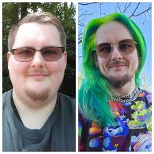 What's the biggest challenge you've faced since surgery?