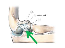 Liebe interessenten, auf den bau der neuen garage oder überstundenreiche wochen. Tennisellenbogen Instabilitat