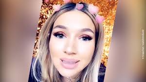 1,485 likes · 3 talking about this. Meine Nasen Op Vorher Video Grund Und Arztwahl By Mariya Lazareva