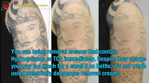 I've read on many sites that once they stopped using hydroquinone that their dark spots return. Lasering Tattoos Off Everything You Must To Know About Tattoo Remove Youtube
