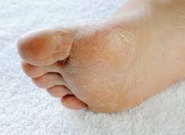 Oct 16, 2017 · mild yeast infections may clear up in as few as three days. Fungal Infections Sepsis Alliance