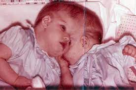 Певец из мозамбика, дебютировавший в 1975 году с синглом «рамайа». Conjoined Twins George And Lori Schappell We Have Normal Lives