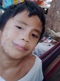 What is the cure for these kind of white marks