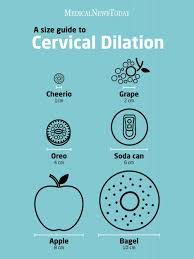 cervix dilation chart stages of labor and what to expect