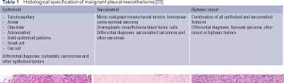 We did not find results for: Pdf Management Of Malignant Pleural Mesothelioma Part 1 Epidemiology Diagnosis And Staging Semantic Scholar
