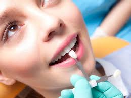 Керамические Виниры ( E-Max Press )