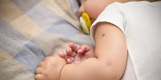 Vor der aufnahme in eine. Roteln Impfung Beim Baby Darum Wird Sie Empfohlen Rossmann De