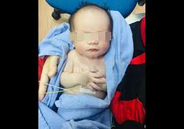 Kebiasaannya, individu tersebut akan mengadu beberapa simptom yang. Bayi Baru Lahir Letak Tangan Atas Dada Macam Solat Dijemput Ilahi Semasa Mstar