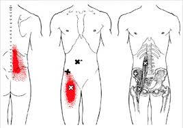 Trigger point therapy instruction from dr. Trigger Point Therapy