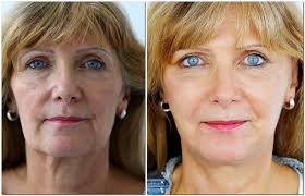 Thomas Haffner's lab