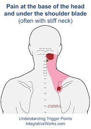 80 valid neck pressure points
