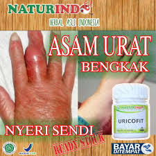 Maybe you would like to learn more about one of these? Obat Asam Urat Paling Ampuhuntuk Penyembuhan Penderita Asam Urat Nyeri Sendi Obat Kaku Pada Tangan Dan Kaki Telapak Tangan Kebas Dan Kesemutan Herbal Uricofit Lazada Indonesia