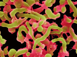 Helicobacter pylori, commonly called h. H Pylori The Silent Killer Living Inside All Of Us Health Fitness Gulf News