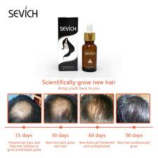 Frequently wearing a hairstyle that pulls on your hair can cause a type of hair loss called traction alopecia. China Fast Hair Growth Oil Products Home Remedies For Hair Regrowth China Hair Growth Oil And Hair Growth Oil Men Price