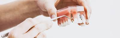 Find funding opportunities, grant programs, and staff contacts. A Comparison Of Dental Implants And Dentures What Suits Me