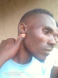 what's the treatment,please??