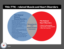 Image result for Myopathy