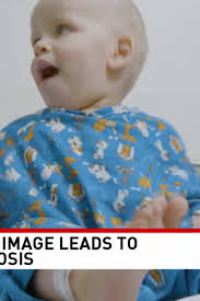 Baby Your Baby- Baby Monitor Image Leads to Cancer Diagnosis