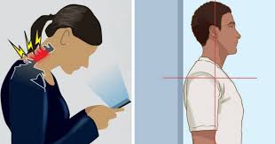 Dowager S Hump Or Postural Kyphosis Is A Condition That Usually Occurs Due To Slouching If Not Treated Properly Dowager Hump Better Posture Neck Exercises
