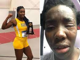 We did not find results for: Moncalieri Daisy Osakue Atleta Italiana Di Origini Africane Aggredita Corriere It