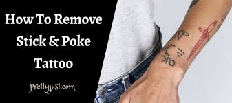 Maybe you would like to learn more about one of these? How To Remove Stick And Poke Tattoo