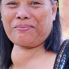 Fundraiser by Cherryl Fitzwater : Goiter Removal Of Mama Gloria