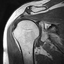 Magnetresonanztomographie Von Gelenken Und Extremitaten Ct Mrt Institut Berlin