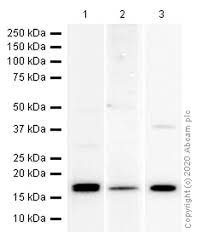Hamster picture 835 1000 jpg. Recombinant Anti Nme2 Antibody Epr8351 Bsa And Azide Free Ab248409 Abcam