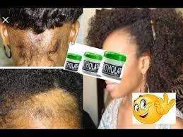 Astuce Comment Faire Pousser Les Cheveux Avec Le Mentholatum Youtube Cheveux Secs Et Cassants Pousse Des Cheveux Faire Pousser Les Cheveux