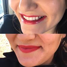 Dentist bought a tube of toothpaste after my appointment