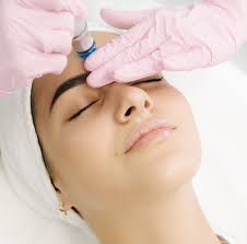 Microneedling, Microneedling Facial, London - Dermacure