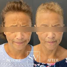 Skin Vitality Medical Clinic