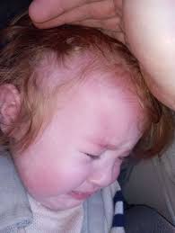 One hell of a crash' as toddlers left bruised during Lynx bus journey from  King's Lynn to Fakenham