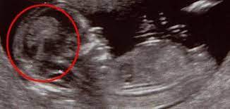 متى يبان نوع الجنين الولد