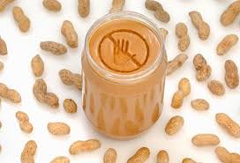 From celebrities shunning gluten to schools banning peanuts, food allergies are all over the news. The Most Common Food Allergies For Kids And Adults