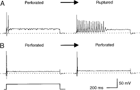 Frontiers | Sensitivity To Extracellular Potassium Underlies Type-Intrinsic  Differences In Retinal Ganglion Cell Excitability