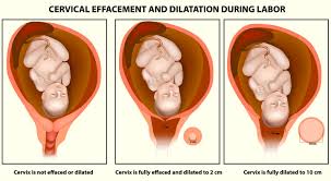 Cervix Dialation Dilated Cervix During Labor 2 Cm Dilated