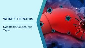 Image result for hepatitis symptoms