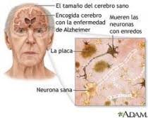 Taller de Salud del Cerebro Módulo 1: Introducción