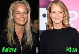 Women really do get a bad deal. Helen Hunt Before And After Plastic Surgery Plastic Surgery Helen Hunt Bad Plastic Surgeries