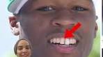 Transformed Smiles: 50 Cent's Dental Makeover Revealed!