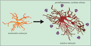 The Role Of Astrocytes In Amyloid Production And Alzheimer S Disease Open Biology