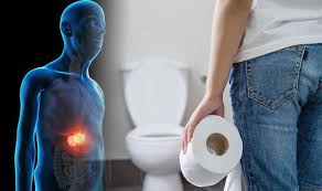 Here, the most common symptoms of pancreatic cancer that you need to know. Pancreatic Cancer Does Your Urine And Stools Look Like This The Hidden Warning Signs Sound Health And Lasting Wealth