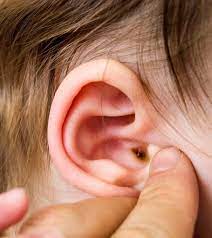 Check spelling or type a new query. How To Clean Baby Earwax Safety And When To See A Doctor