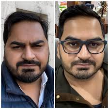 What is a good way to start intermittent fasting?