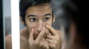 One of the most common indicators of marijuana use is red eyes. Does Smoking Weed Cause Acne