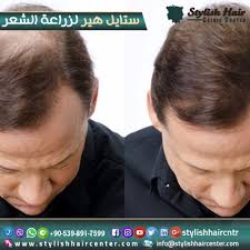 تمتع بمظهر شبابي متألق نقدم لكم أحدث ماتوصل إليه الطب في زراعة الشعر و زراعة الرموش والحواجب كما نوظف البلازما الأمريكية وتقنية الا Stylish Hair Hair Stylish