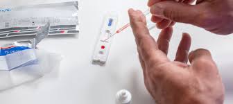 Тесты на антитела при covid. Q A Covid 19 Antibody Testing Events Imperial College London