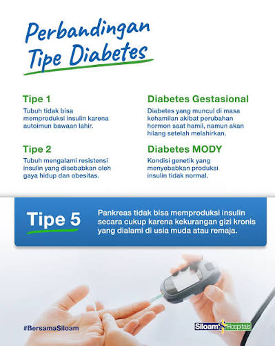 Kabar terbaru dari dunia medis: Diabetes Tipe 5 sudah diakui di kongres diabetes  dunia pada April 2025 kemarin. Apa yang membedakannya dari kategori diabetes  yang sudah muncul sebelumnya? Cek konten ini untuk